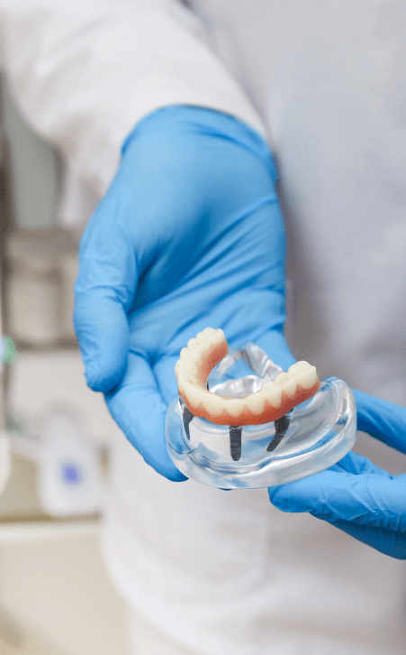 the cost of dental implants