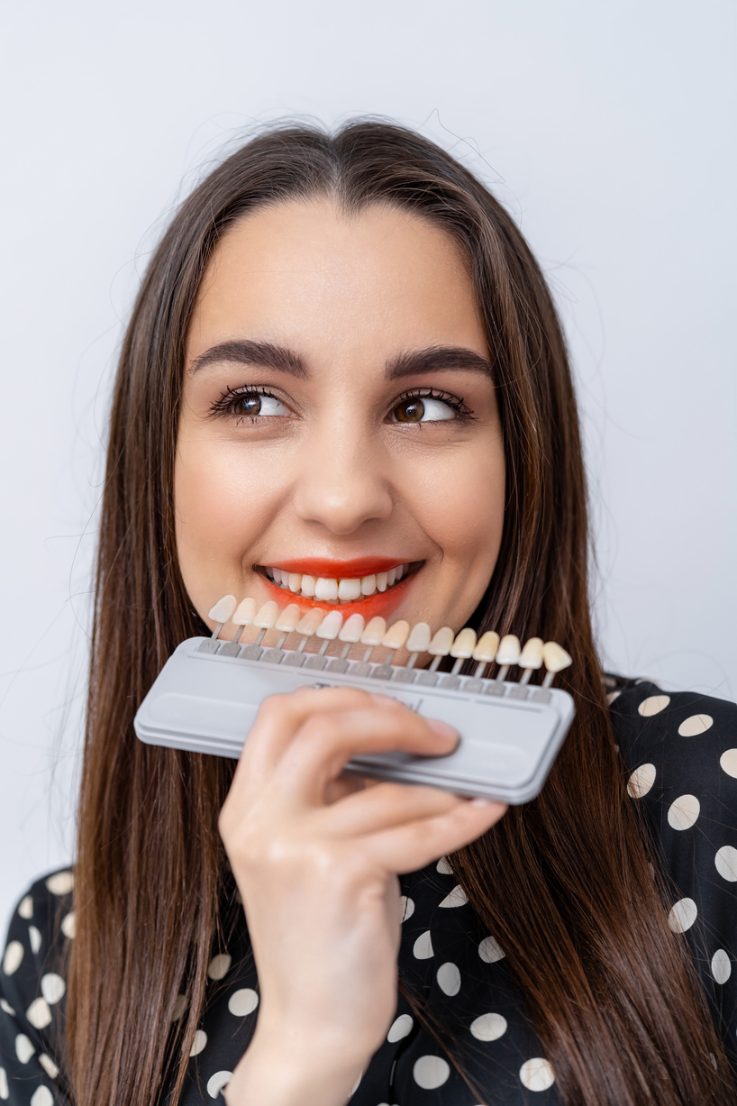 Palette with shades of teeth. Dental samples of tint teeth. Girl with red lips chooses perfect teeth color. Closeup.