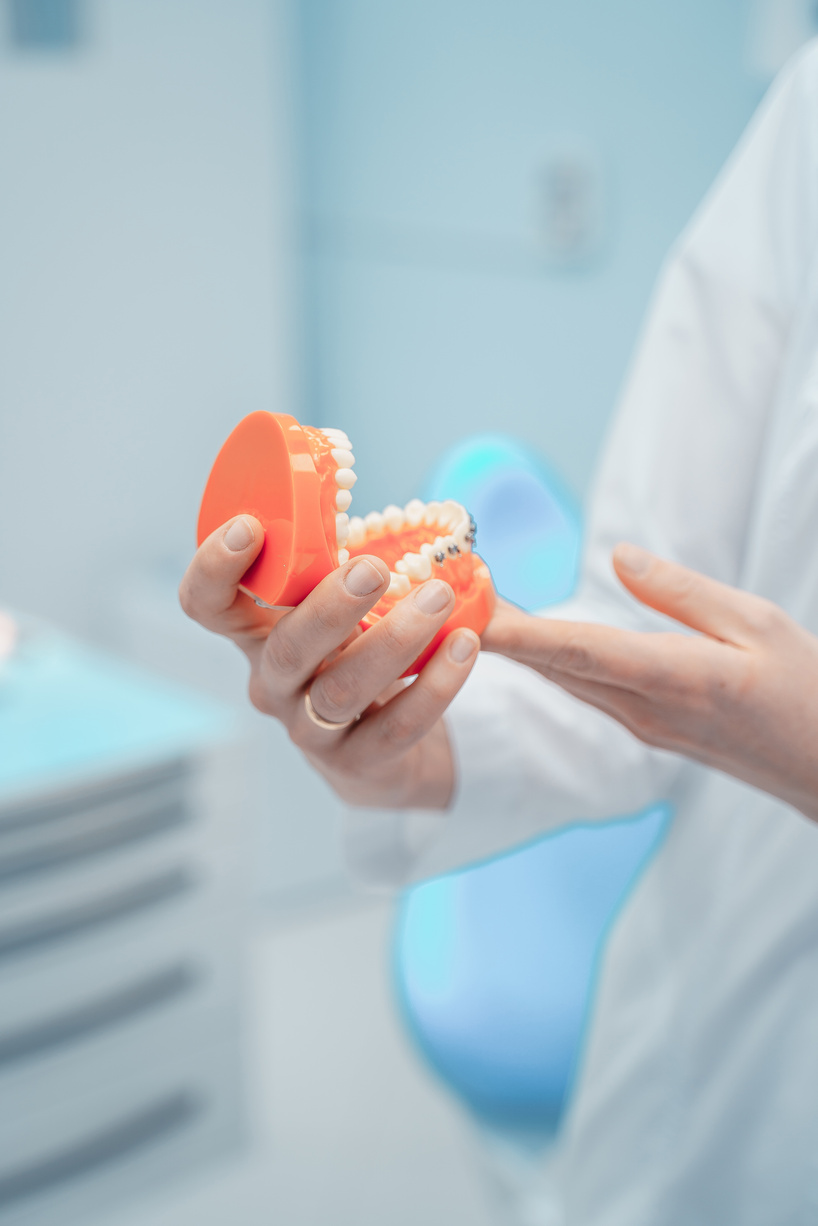 full dentures in orange color in the hands of a medical worker. High quality photo