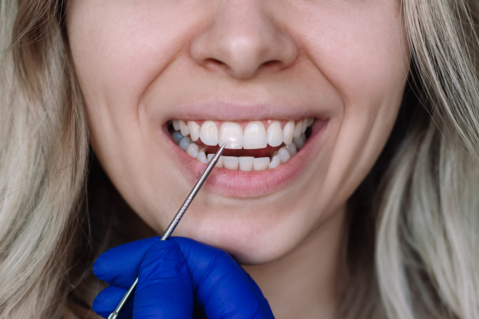 AdobeStock 714215124 - Seattle Dental Studio